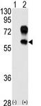 Kringle Containing Transmembrane Protein 1 antibody, AP11560PU-N, Origene, Western Blot image 