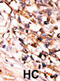 MAPK Activated Protein Kinase 5 antibody, abx031875, Abbexa, Immunohistochemistry paraffin image 