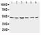 Presenilin 2 antibody, GTX11661, GeneTex, Western Blot image 