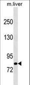 Cbl Proto-Oncogene B antibody, LS-C158182, Lifespan Biosciences, Western Blot image 