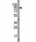 Transient Receptor Potential Cation Channel Subfamily V Member 3 antibody, F43674-0.4ML, NSJ Bioreagents, Western Blot image 