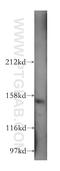 Adaptor Related Protein Complex 3 Subunit Beta 1 antibody, 13384-1-AP, Proteintech Group, Western Blot image 