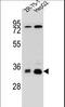 Methylenetetrahydrofolate Dehydrogenase (NADP+ Dependent) 2 Like antibody, LS-C164663, Lifespan Biosciences, Western Blot image 