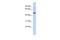 Zinc Finger And SCAN Domain Containing 1 antibody, A16981, Boster Biological Technology, Western Blot image 