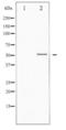 Vitamin D Receptor antibody, LS-C416538, Lifespan Biosciences, Western Blot image 