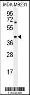 Alpha-Methylacyl-CoA Racemase antibody, 55-041, ProSci, Western Blot image 