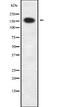 Capicua Transcriptional Repressor antibody, orb336259, Biorbyt, Western Blot image 