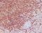 BCL2 antibody, M00040-1, Boster Biological Technology, Immunohistochemistry frozen image 