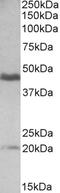 GATA Binding Protein 3 antibody, EB05570, Everest Biotech, Western Blot image 