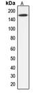 ATP Binding Cassette Subfamily C Member 12 antibody, LS-C353614, Lifespan Biosciences, Western Blot image 