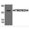 Transmembrane Protein 204 antibody, MBS151496, MyBioSource, Western Blot image 