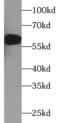 Tyrosine Hydroxylase antibody, FNab09870, FineTest, Western Blot image 
