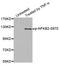 Nuclear Factor Kappa B Subunit 2 antibody, STJ22314, St John