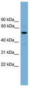 Ankyrin Repeat, SAM And Basic Leucine Zipper Domain Containing 1 antibody, TA340257, Origene, Western Blot image 