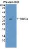 Plasminogen activator inhibitor 2 type A antibody, abx132061, Abbexa, Western Blot image 