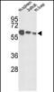 Insulin Like Growth Factor Binding Protein Acid Labile Subunit antibody, PA5-72517, Invitrogen Antibodies, Western Blot image 