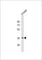 Chitobiase antibody, 61-248, ProSci, Western Blot image 