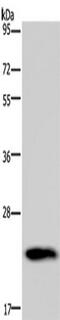 Growth Hormone 2 antibody, TA350016, Origene, Western Blot image 