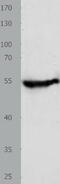 Cyclase Associated Actin Cytoskeleton Regulatory Protein 2 antibody, TA322504, Origene, Western Blot image 