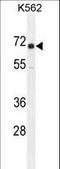 Insulin Like Growth Factor 2 MRNA Binding Protein 1 antibody, LS-C165144, Lifespan Biosciences, Western Blot image 