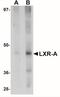 Nuclear Receptor Subfamily 1 Group H Member 3 antibody, NBP1-77106, Novus Biologicals, Western Blot image 