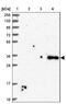 Secreted Frizzled Related Protein 4 antibody, NBP2-38632, Novus Biologicals, Western Blot image 