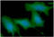 Keratin 5 antibody, GTX57627, GeneTex, Immunofluorescence image 