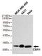 Carbonyl Reductase 1 antibody, GTX49137, GeneTex, Western Blot image 
