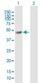 Inositol Polyphosphate-5-Phosphatase K antibody, H00051763-B01P, Novus Biologicals, Western Blot image 