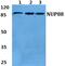 Nucleoporin 88 antibody, PA5-37004, Invitrogen Antibodies, Western Blot image 