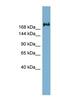 Transmembrane protein 2 antibody, NBP1-91561, Novus Biologicals, Western Blot image 