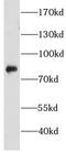 Checkpoint With Forkhead And Ring Finger Domains antibody, FNab01648, FineTest, Western Blot image 