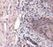 Succinate Dehydrogenase Complex Iron Sulfur Subunit B antibody, NBP1-54154, Novus Biologicals, Immunohistochemistry paraffin image 