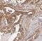 Activated Leukocyte Cell Adhesion Molecule antibody, FNab00280, FineTest, Immunohistochemistry paraffin image 