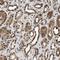 Tousled Like Kinase 1 antibody, HPA016043, Atlas Antibodies, Immunohistochemistry paraffin image 