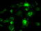 B-Raf Proto-Oncogene, Serine/Threonine Kinase antibody, LS-C114544, Lifespan Biosciences, Immunofluorescence image 