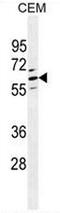 C-Type Lectin Domain Family 4 Member F antibody, AP50963PU-N, Origene, Western Blot image 