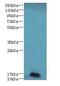 Nuclear Receptor 2C2 Associated Protein antibody, LS-C397105, Lifespan Biosciences, Western Blot image 