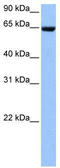 Collagen Type IV Alpha 3 Binding Protein antibody, TA340204, Origene, Western Blot image 