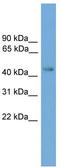 ERCC Excision Repair 8, CSA Ubiquitin Ligase Complex Subunit antibody, TA344281, Origene, Western Blot image 