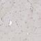 GDP-Mannose 4,6-Dehydratase antibody, NBP1-83357, Novus Biologicals, Immunohistochemistry paraffin image 