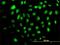 Helicase With Zinc Finger antibody, H00009931-M02, Novus Biologicals, Immunocytochemistry image 