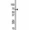 Enhancer Of Zeste 1 Polycomb Repressive Complex 2 Subunit antibody, F48072-0.4ML, NSJ Bioreagents, Immunohistochemistry paraffin image 