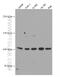 Nucleotide Binding Oligomerization Domain Containing 2 antibody, 66710-1-Ig, Proteintech Group, Western Blot image 