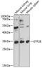 General Transcription Factor IIB antibody, 16-857, ProSci, Western Blot image 