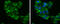 Glycerol Kinase antibody, GTX102297, GeneTex, Immunocytochemistry image 