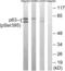 Tumor Protein P63 antibody, abx012715, Abbexa, Western Blot image 