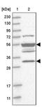 Transmembrane Protein With Metallophosphoesterase Domain antibody, PA5-55484, Invitrogen Antibodies, Western Blot image 