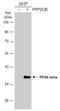 Protein Phosphatase 2 Catalytic Subunit Beta antibody, NBP1-32069, Novus Biologicals, Western Blot image 