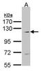 ACK1 antibody, PA5-28389, Invitrogen Antibodies, Western Blot image 
